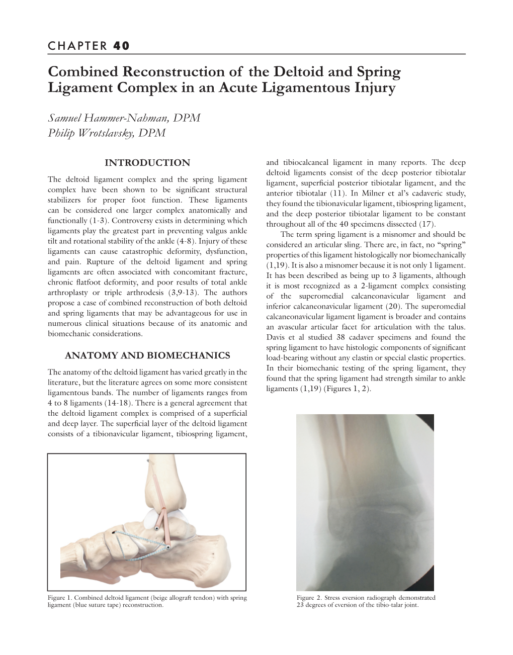 Combined Reconstruction of the Deltoid and Spring Ligament Complex in an Acute Ligamentous Injury