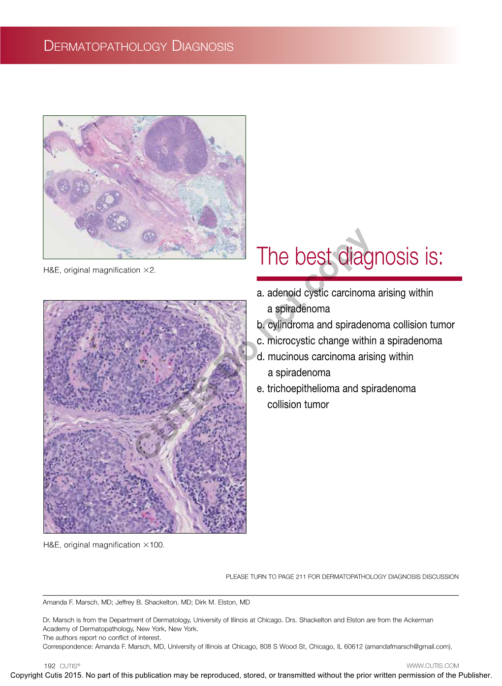 The Best Diagnosis Is: H&E, Original Magnification 2