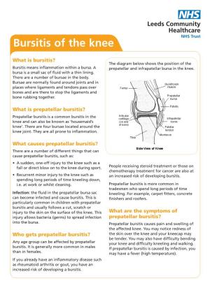Bursitis of the Knee
