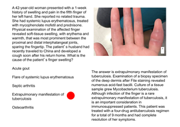A 42-Year-Old Woman Presented with a 1-Week History of Swelling and Pain in the Fifth Finger of Her Left Hand