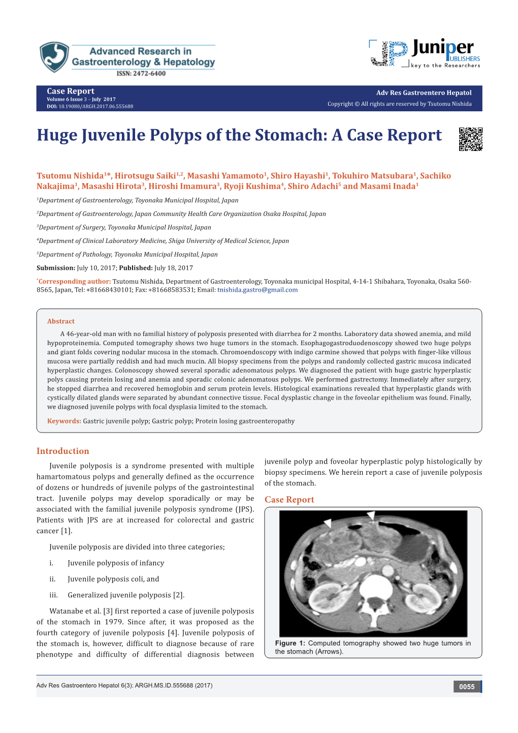 Huge Juvenile Polyps of the Stomach: a Case Report