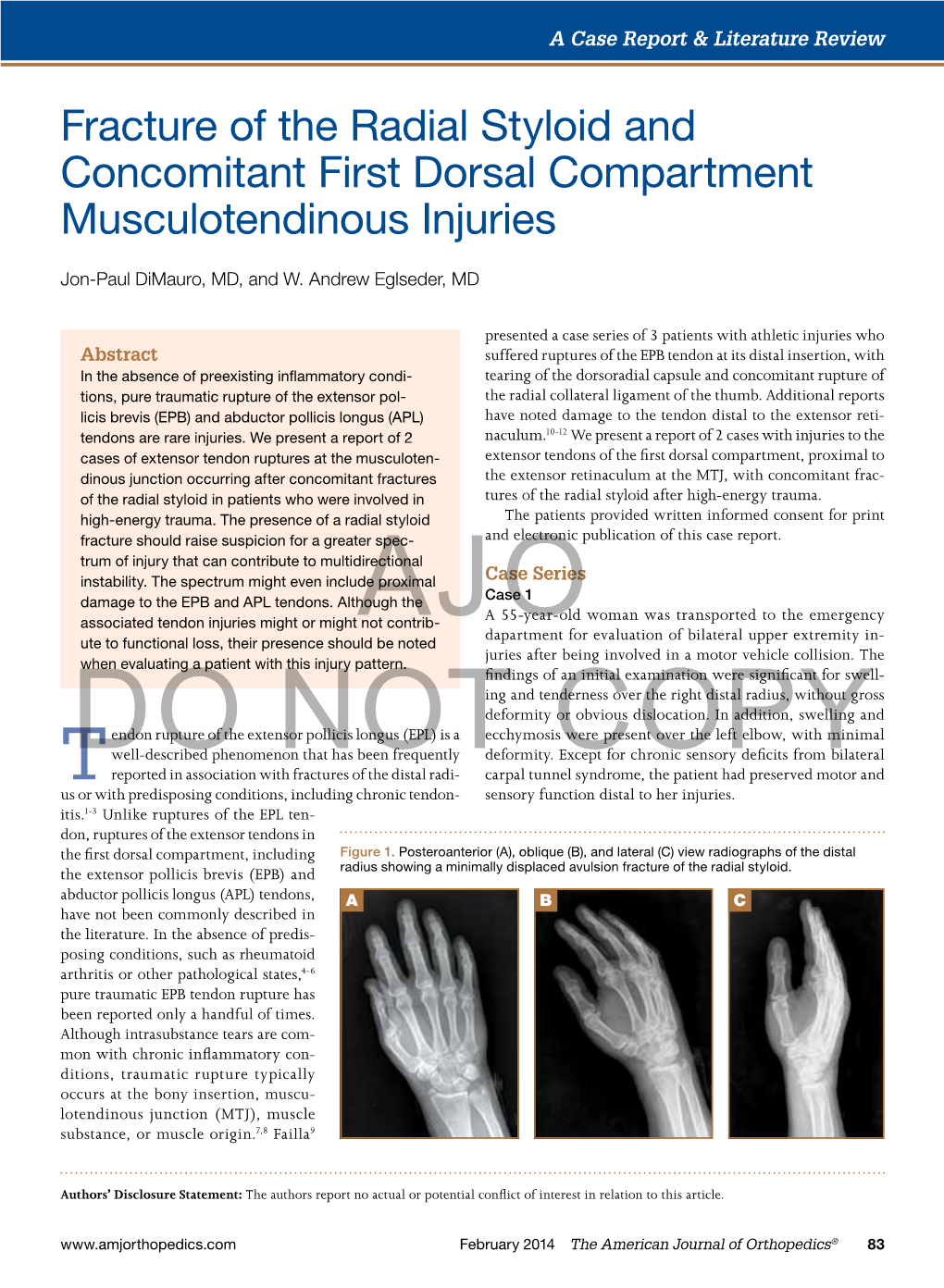 Concomitant Ulnar Styloid Fracture And Distal Radius 