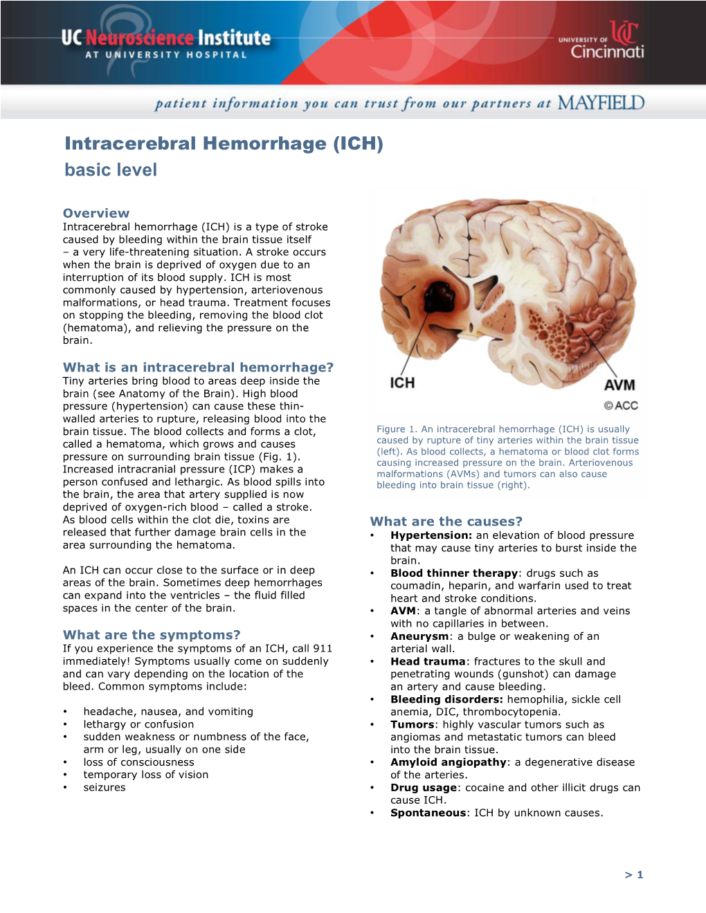 Intracerebral Hemorrhage (ICH) Basic Level