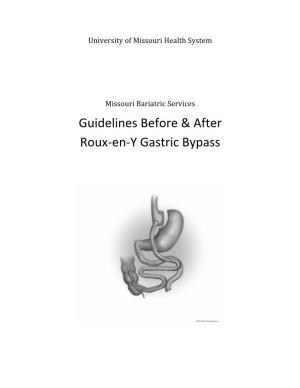 Guidelines Before & After Roux-En-Y Gastric Bypass