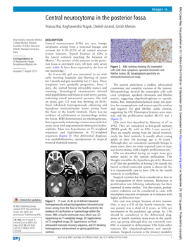 Central Neurocytoma in the Posterior Fossa Pranav Rai, Raghavendra Nayak, Debish Anand, Girish Menon