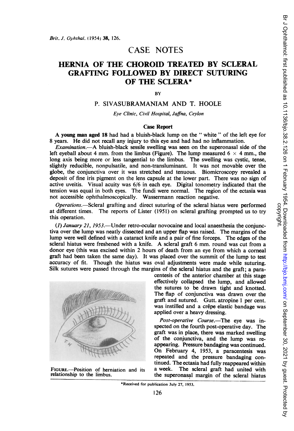 Case Notes Hernia of the Choroid Treated by Scleral Grafting Followed by Direct Suturing of the Sclera* by P