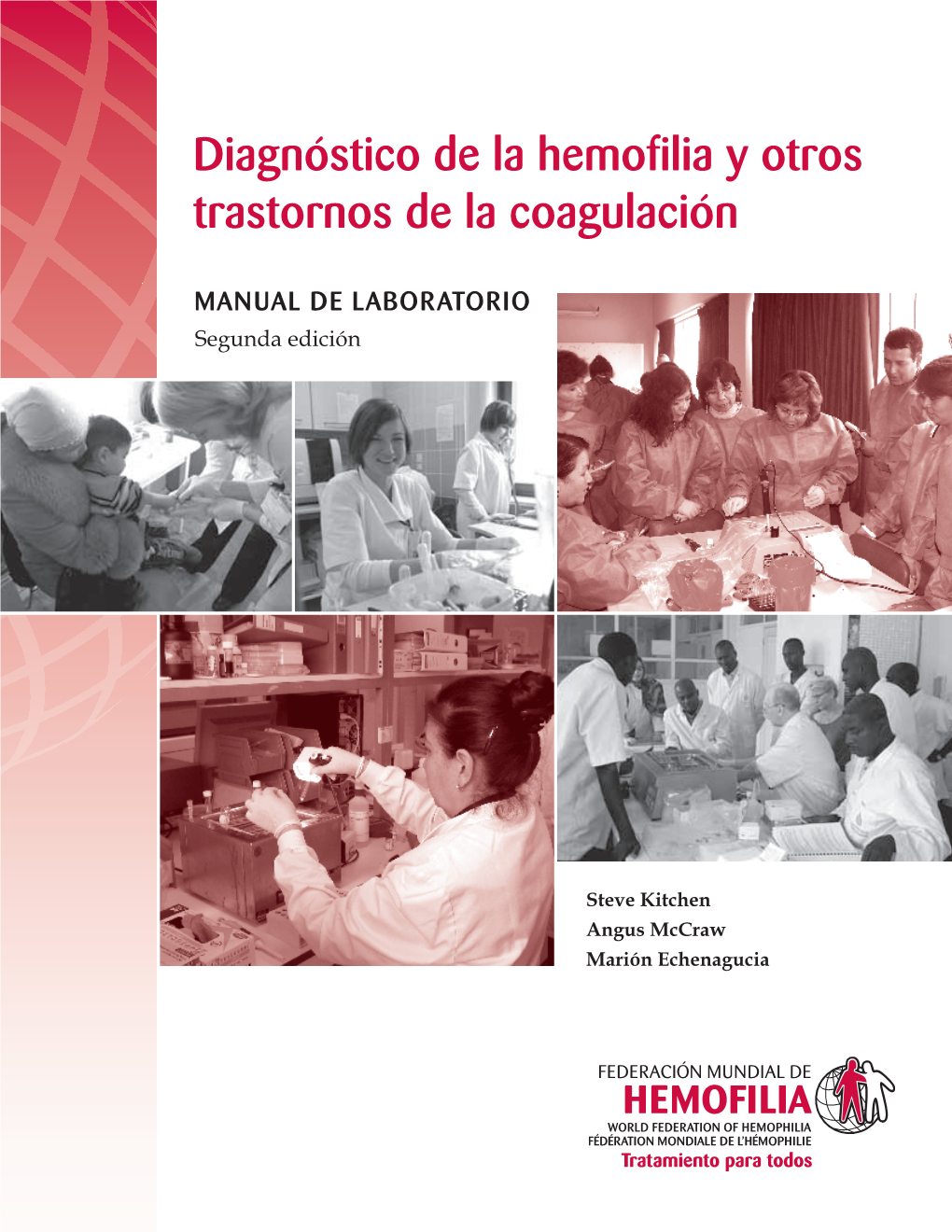 DIAGNÓSTICO DE LA HEMOFILIA Y OTROS TRASTORNOS DE LA COAGULACIÓN Veriﬁ Cación Calibración De Pipetas Y Balanzas 2