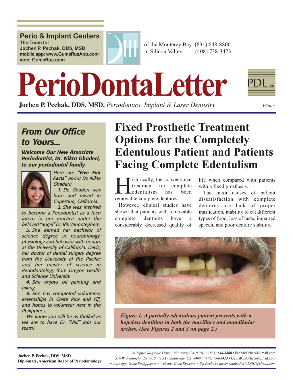 Full-Arch, Implant- Supported Metal- Ceramic Fixed Dentures