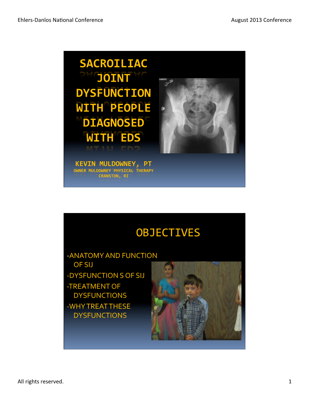 Sacroiliac Joint Dysfunction with People Diagnosed with Eds