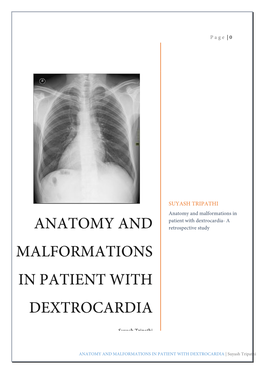 Anatomy and Malformations in Patient with Dextrocardia- a ANATOMY and Retrospective Study MALFORMATIONS in PATIENT with DEXTROCARDIA