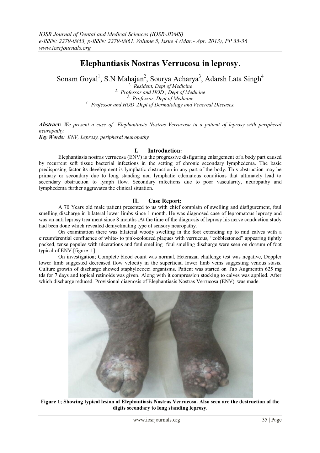 Elephantiasis Nostras Verrucosa in Leprosy