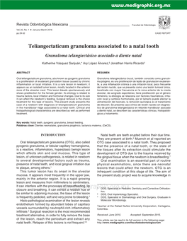 Teliangectaticum Granuloma Associated to a Natal Tooth Granuloma Telangiectásico Asociado a Diente Natal