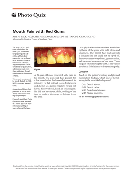 Mouth Pain with Red Gums AMY M