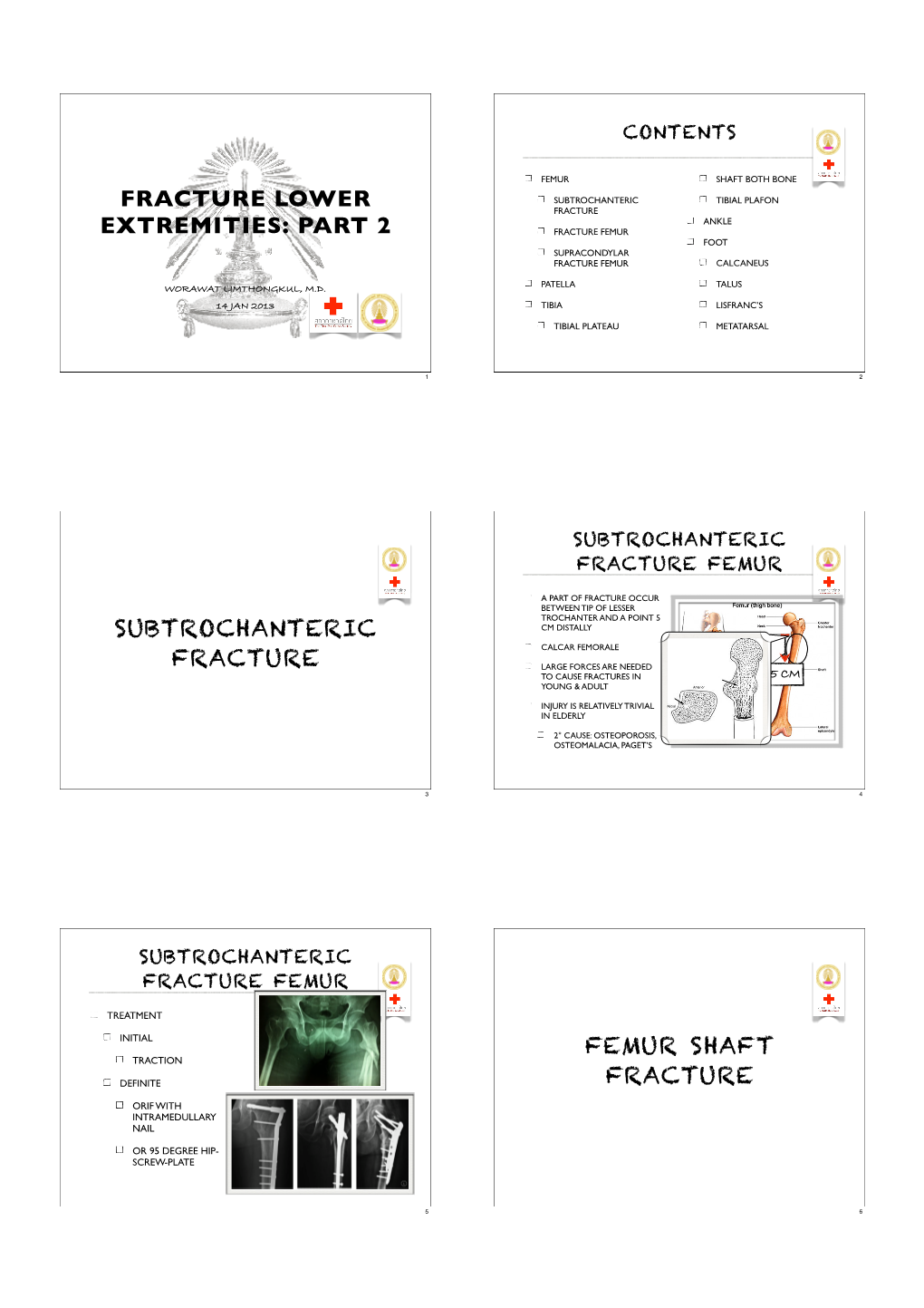 Fracture Lower Extremity Part II