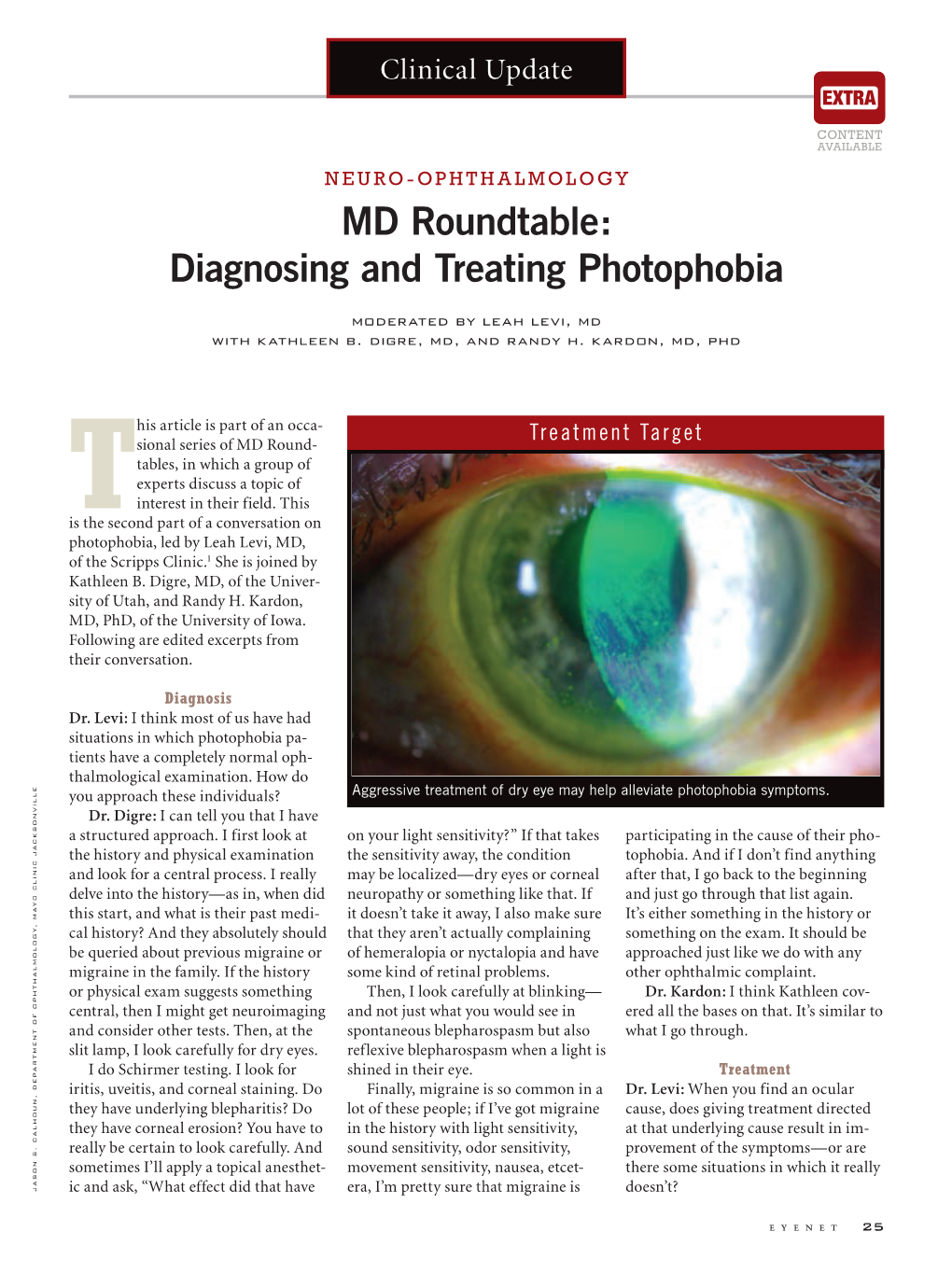 MD Roundtable: Diagnosing and Treating Photophobia