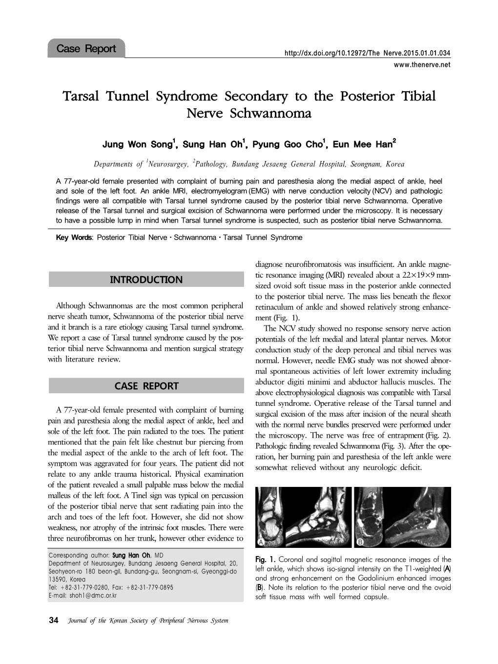 Tarsal Tunnel Syndrome Secondary to the Posterior Tibial Nerve Schwannoma