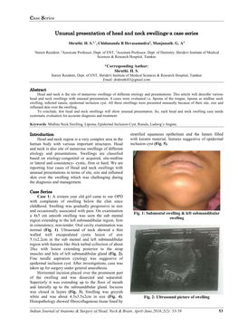Unusual Presentation of Head and Neck Swellings-A Case Series