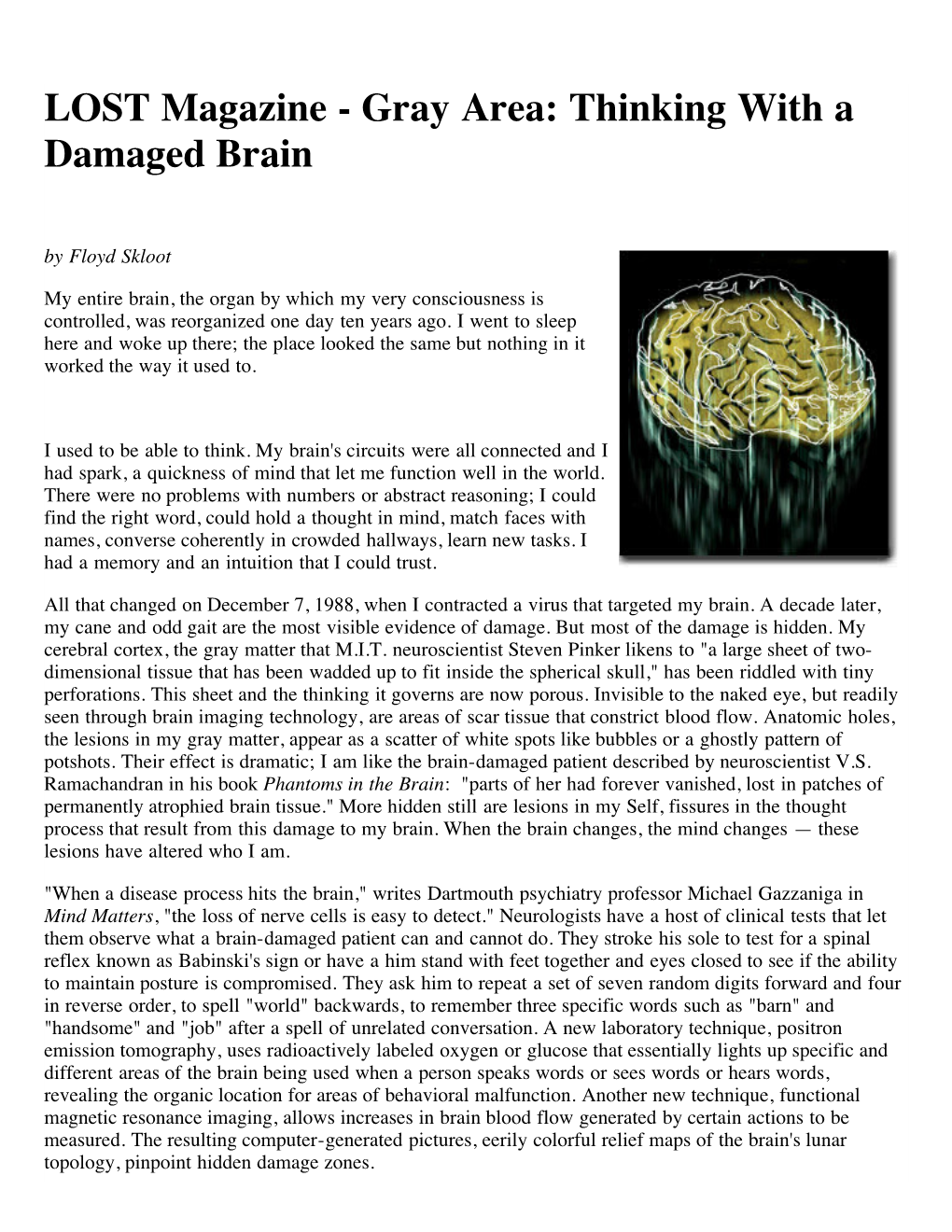 Gray Area: Thinking with a Damaged Brain