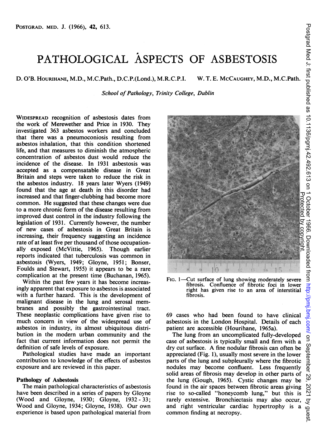 Pathological Aspects of Asbestosis