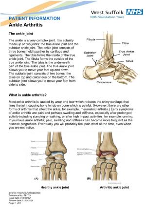 PATIENT INFORMATION Ankle Arthritis