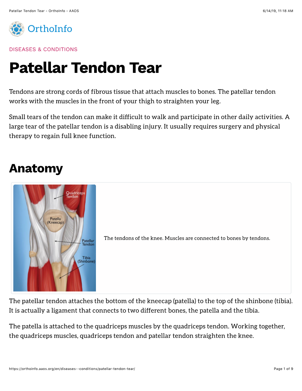 Patellar Tendon Tear - Orthoinfo - AAOS 6/14/19, 11:18 AM