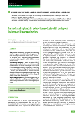 Immediate Implants in Extraction Sockets with Periapical Lesions: an Illustrated Review