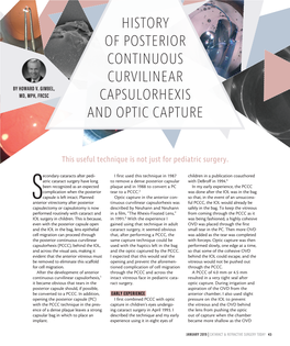 History of Posterior Continuous Curvilinear Capsulorhexis and Optic