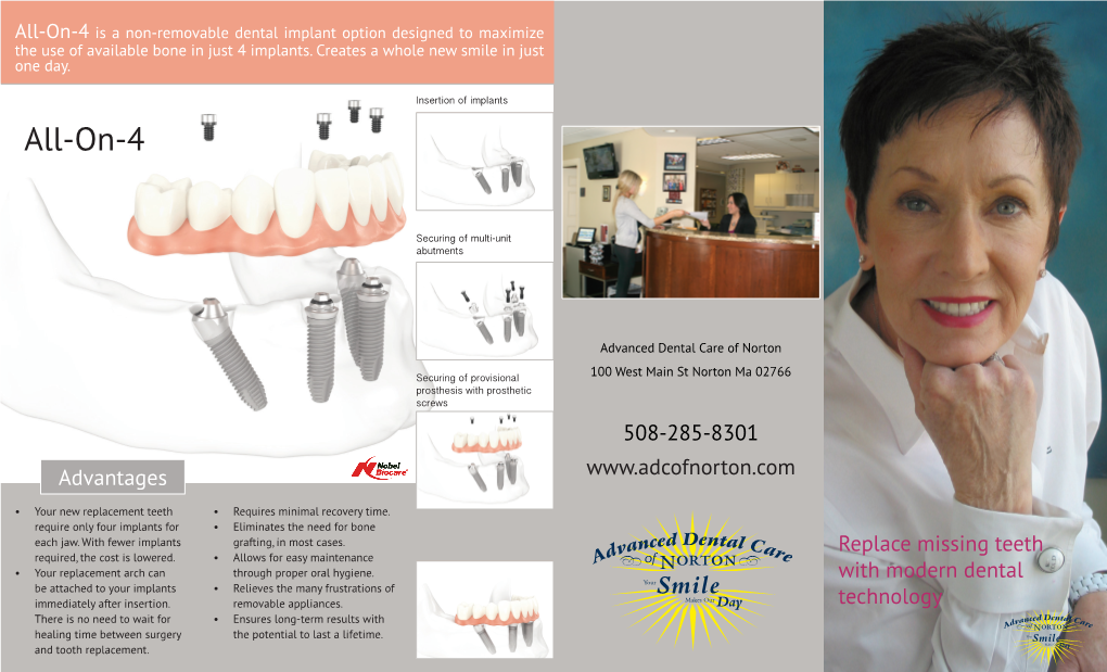 All-On-4 Is a Non-Removable Dental Implant Option Designed to Maximize the Use of Available Bone in Just 4 Implants