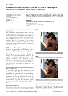 Ameloblastic Fibro-Odontoma of the Maxilla: a Case Report Belal Alani, Muraja Aldoori, Amar Adham, Farag Ismail