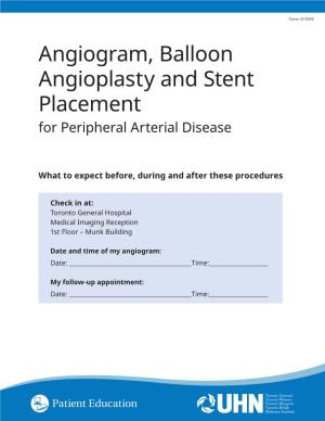 Angiogram, Balloon Angioplasty and Stent Placement for Peripheral Arterial Disease