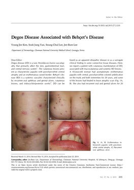 Degos Disease Associated with Behçet's Disease