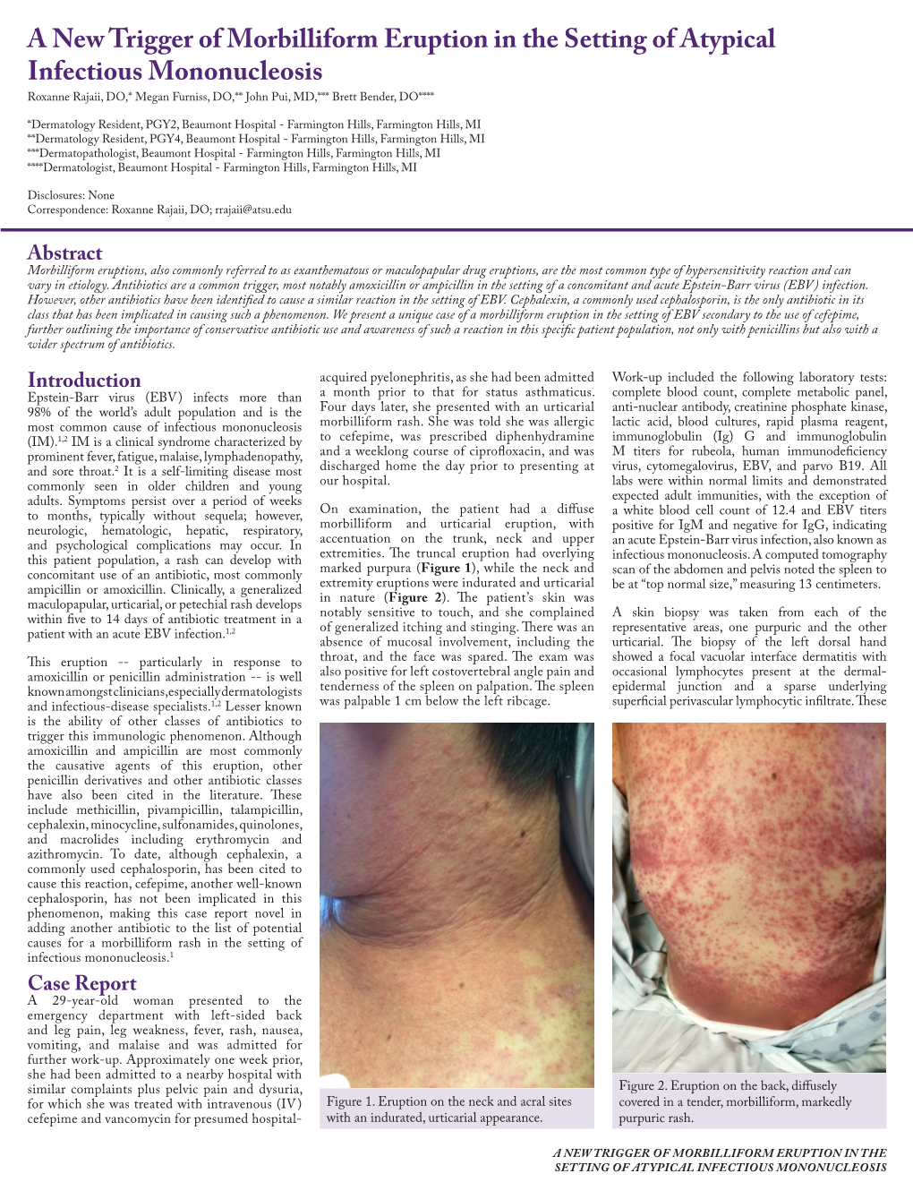 A New Trigger of Morbilliform Eruption in the Setting of Atypical Infectious