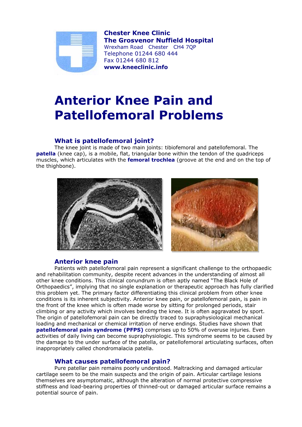 Anterior Knee Pain and Patellofemoral Problems