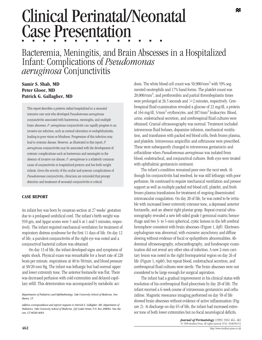 Pseudomonas Aeruginosa Conjunctivitis