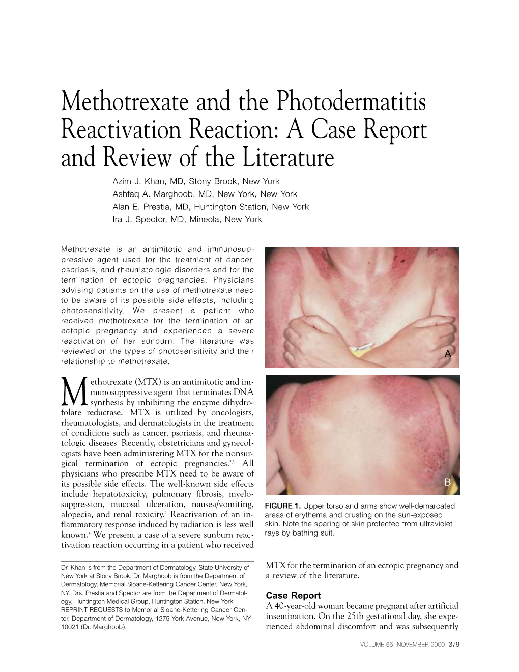 Methotrexate And The Photodermatitis Reactivation Reaction A Case   Methotrexate And The Photodermatitis Reactivation Reaction A Case Report And Review Of The Literature Azim J 