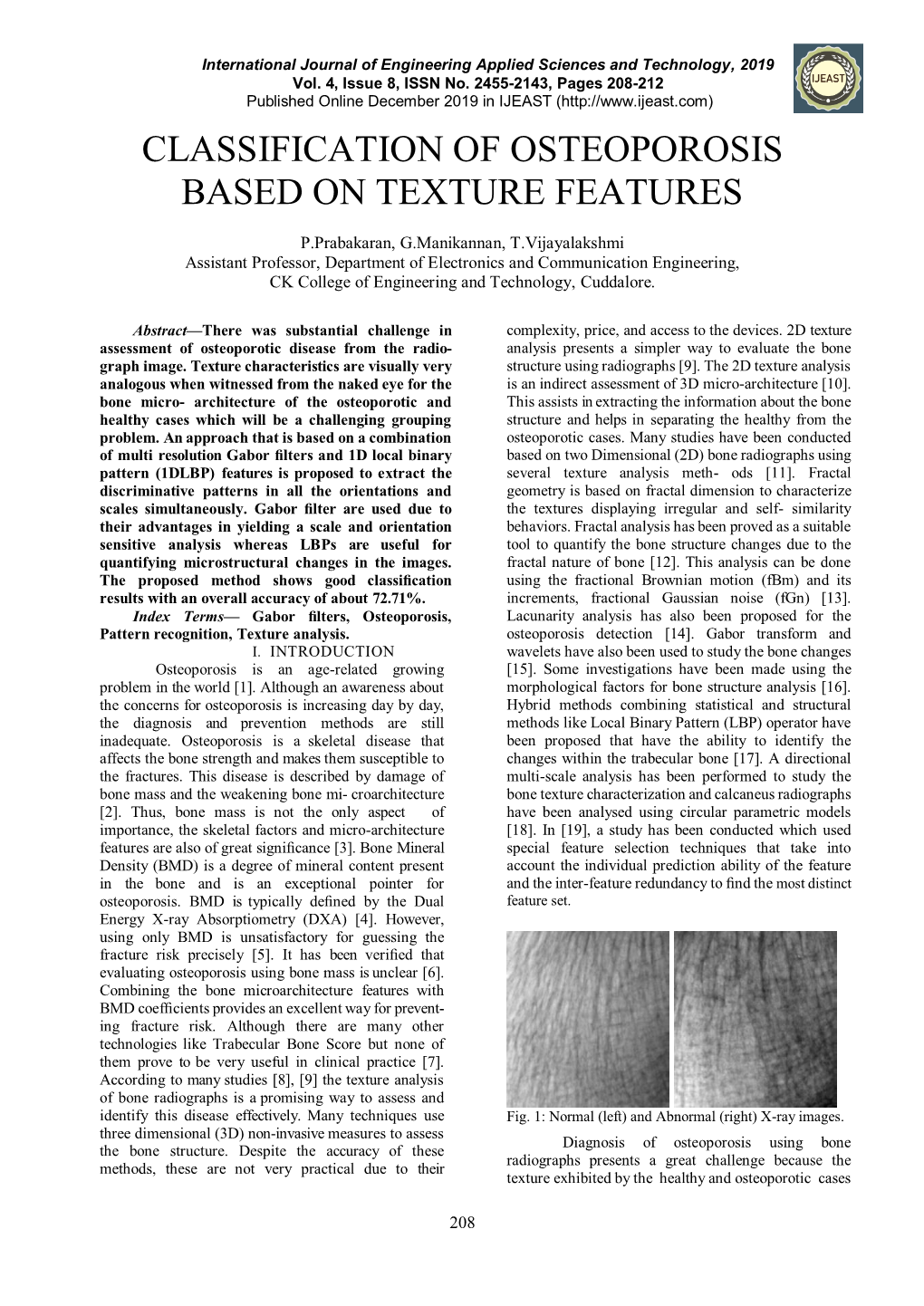 Classification of Osteoporosis Based on Texture Features