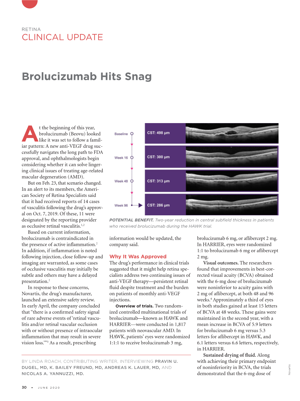 Brolucizumab Hits Snag