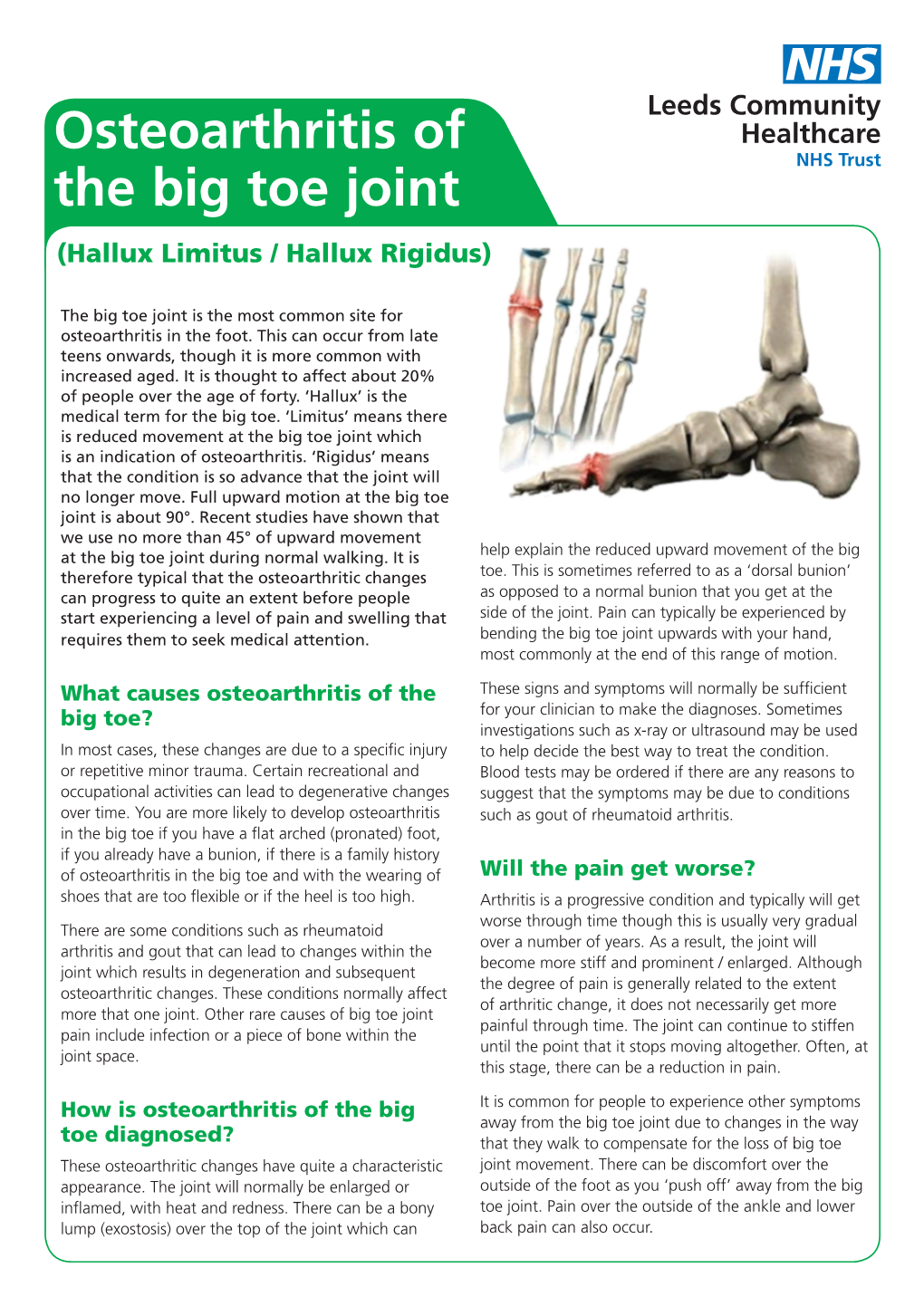 Osteoarthritis Of The Big Toe Joint (Hallux Limitus / Hallux Rigidus ...