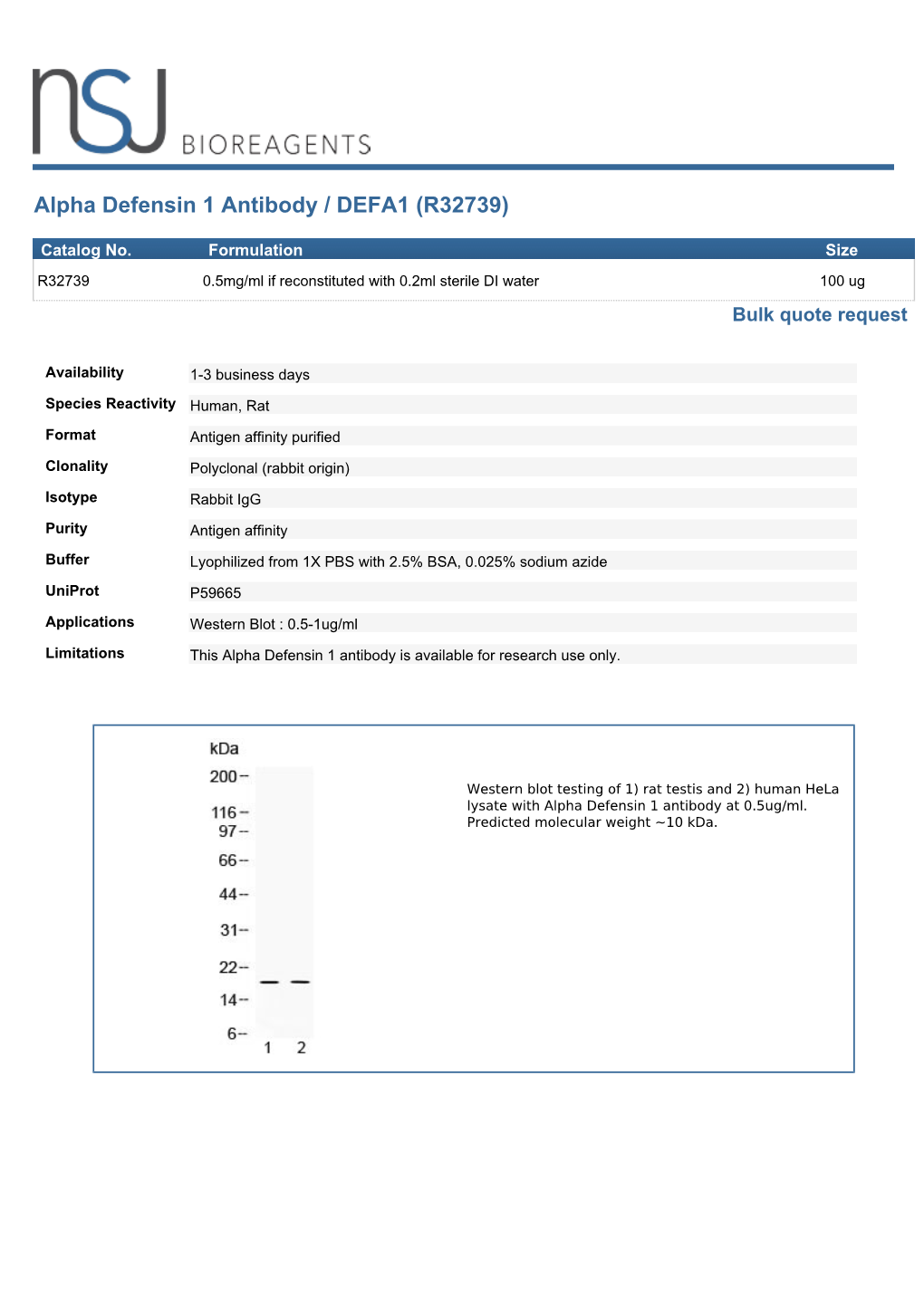 Alpha Defensin 1 Antibody / DEFA1 (R32739)