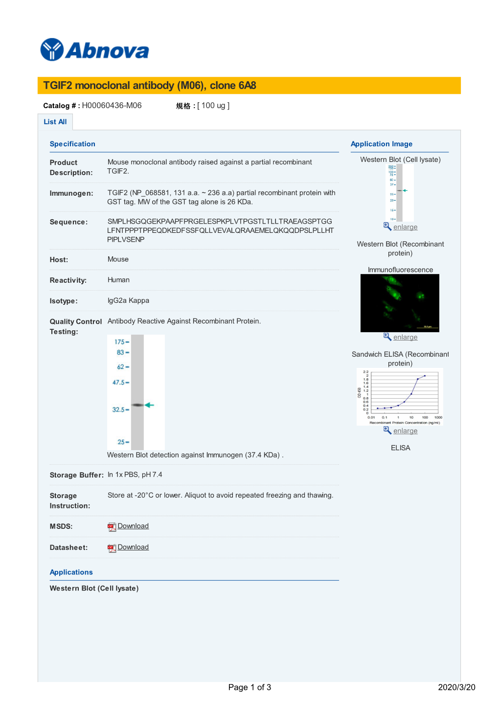 TGIF2 Monoclonal Antibody (M06), Clone 6A8