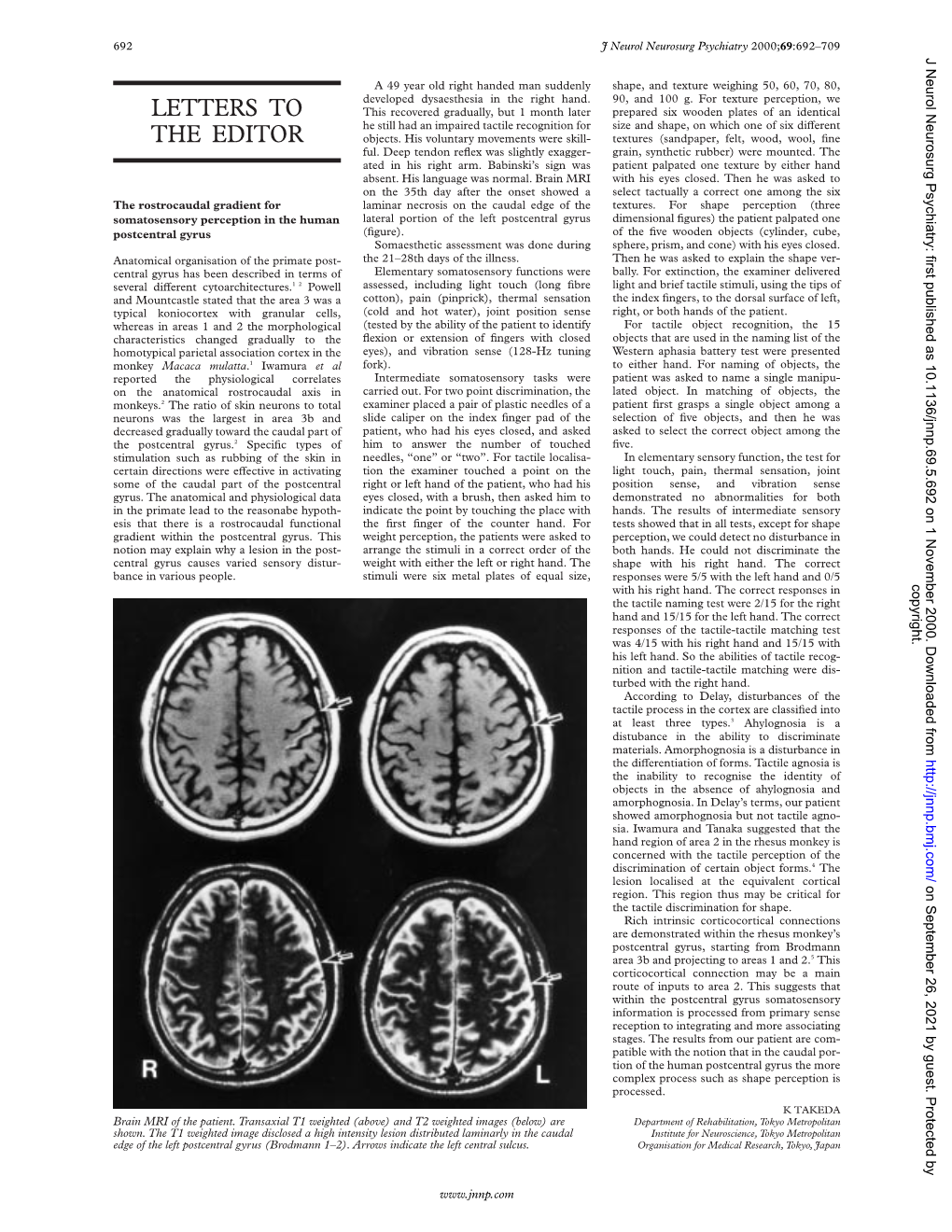 The Rostrocaudal Gradient for Somatosensory Perception in The