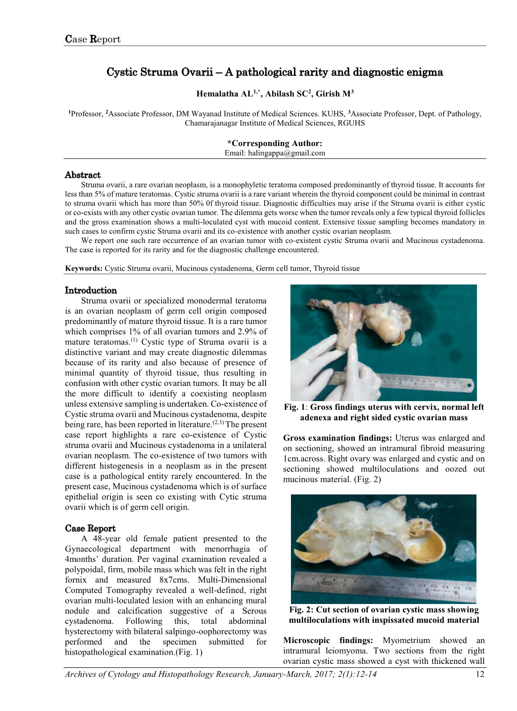 Cystic Struma Ovarii – a Pathological Rarity and Diagnostic Enigma