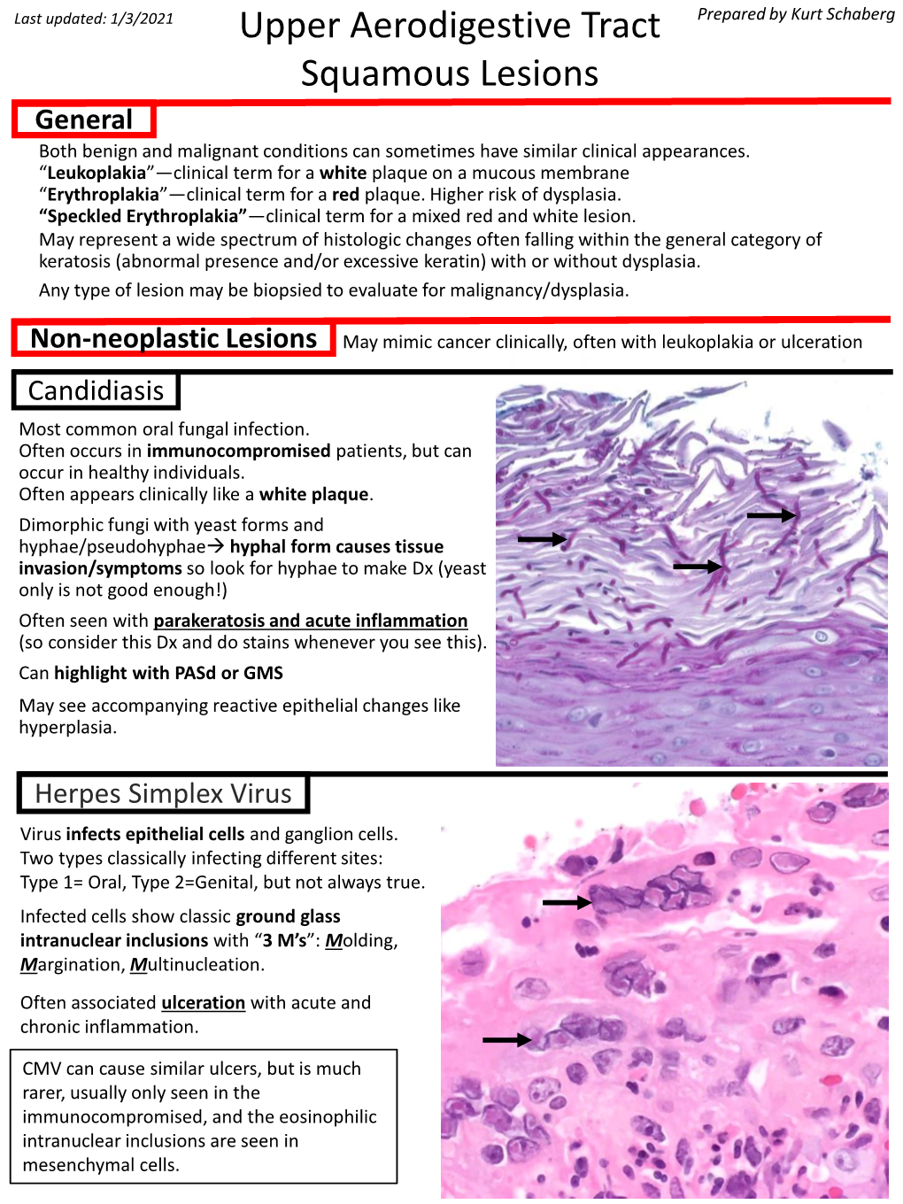 Upper Aerodigestive Tract Squamous Lesions - DocsLib