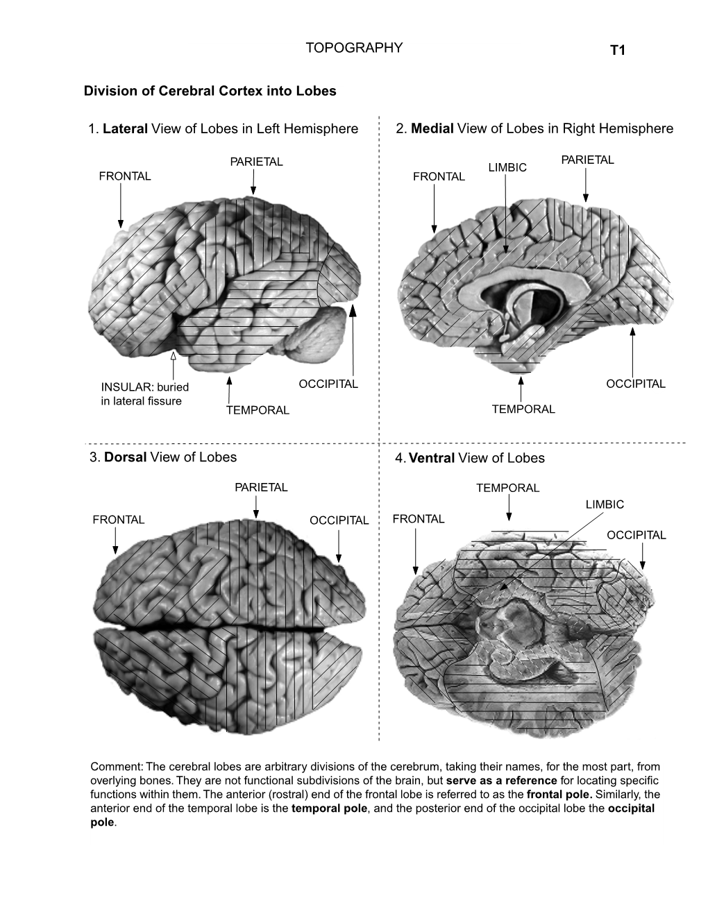 1. Lateral View of Lobes in Left Hemisphere TOPOGRAPHY