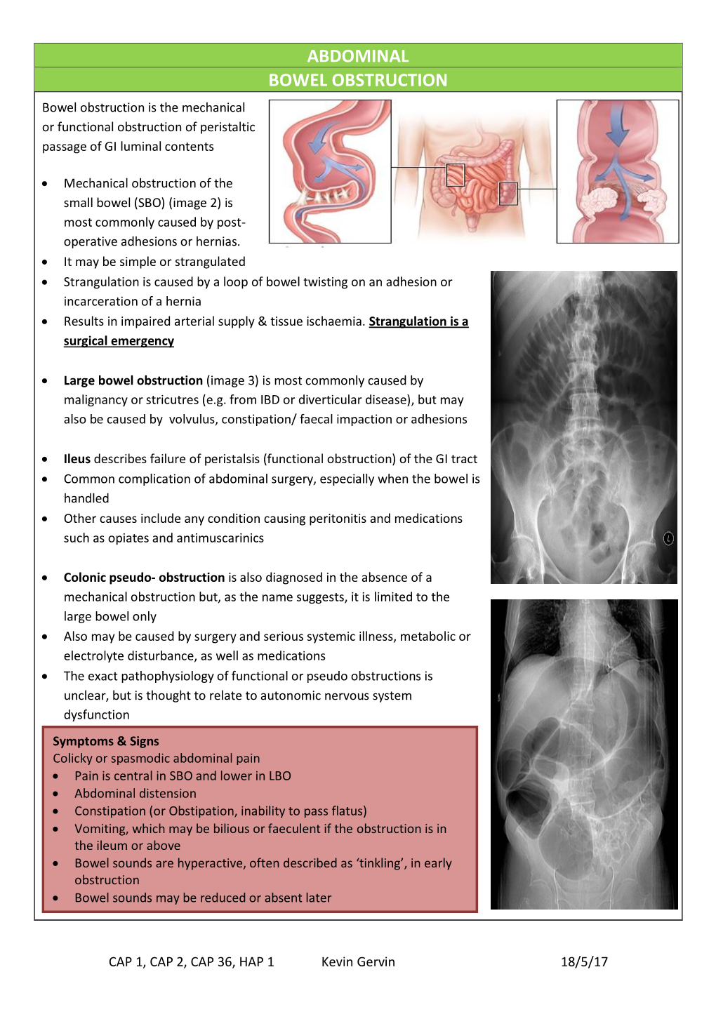 Abdominal Bowel Obstruction Bowel Obstruction Is The Mechanical Or Functional Obstruction Of Peristaltic Passage Of Gi Luminal Contents 