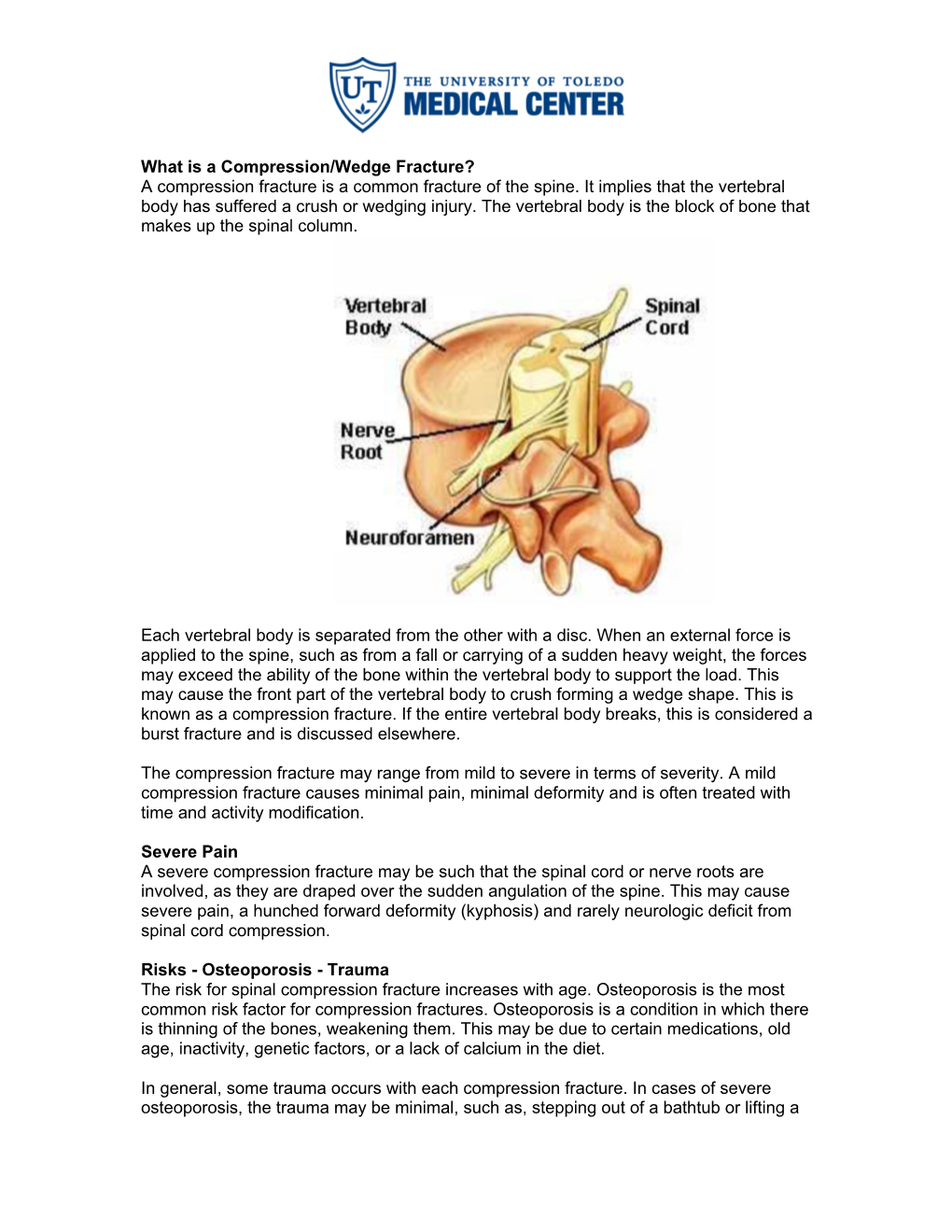 What Is a Compression/Wedge Fracture? a Compression Fracture Is a ...