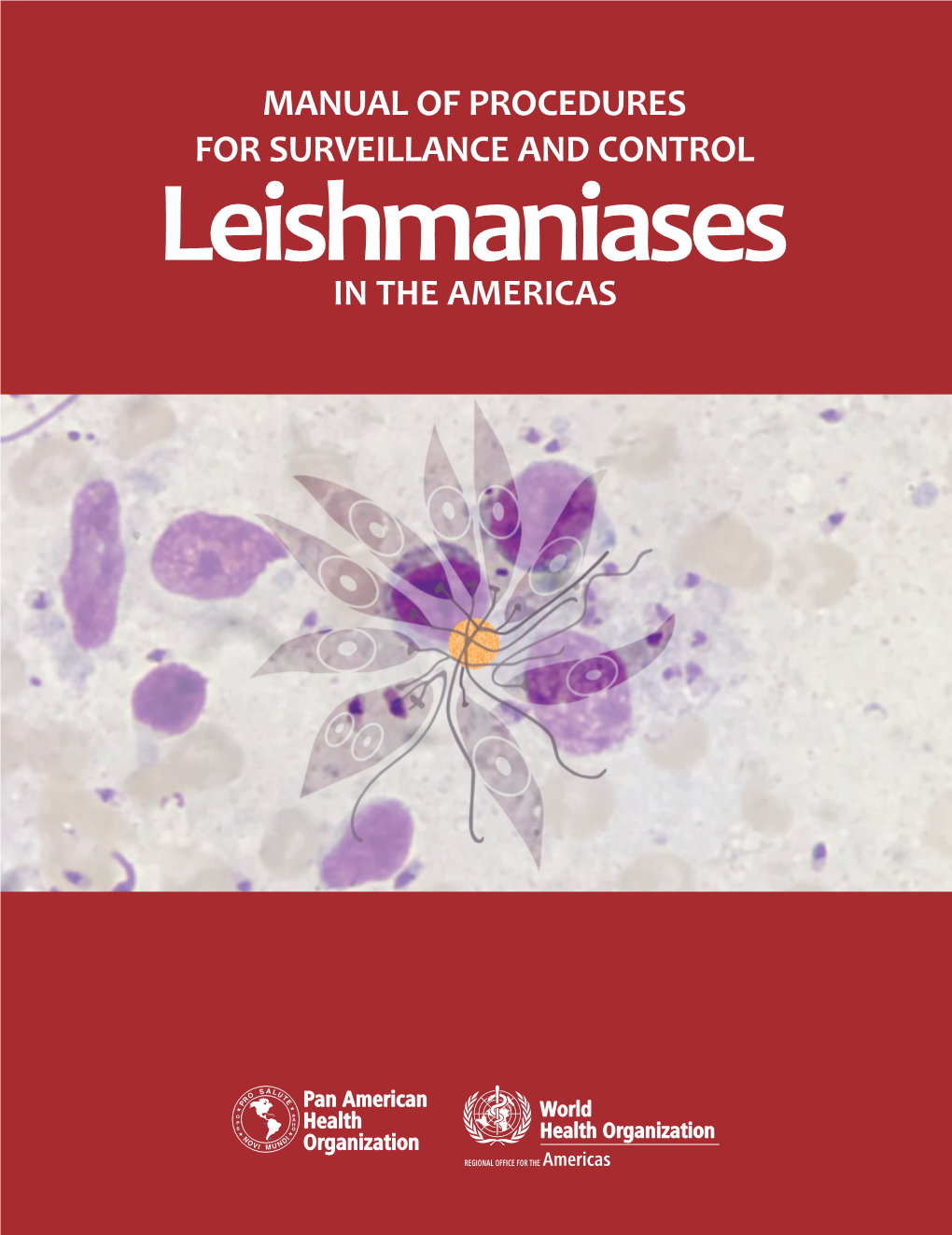 Leishmaniases in the AMERICAS