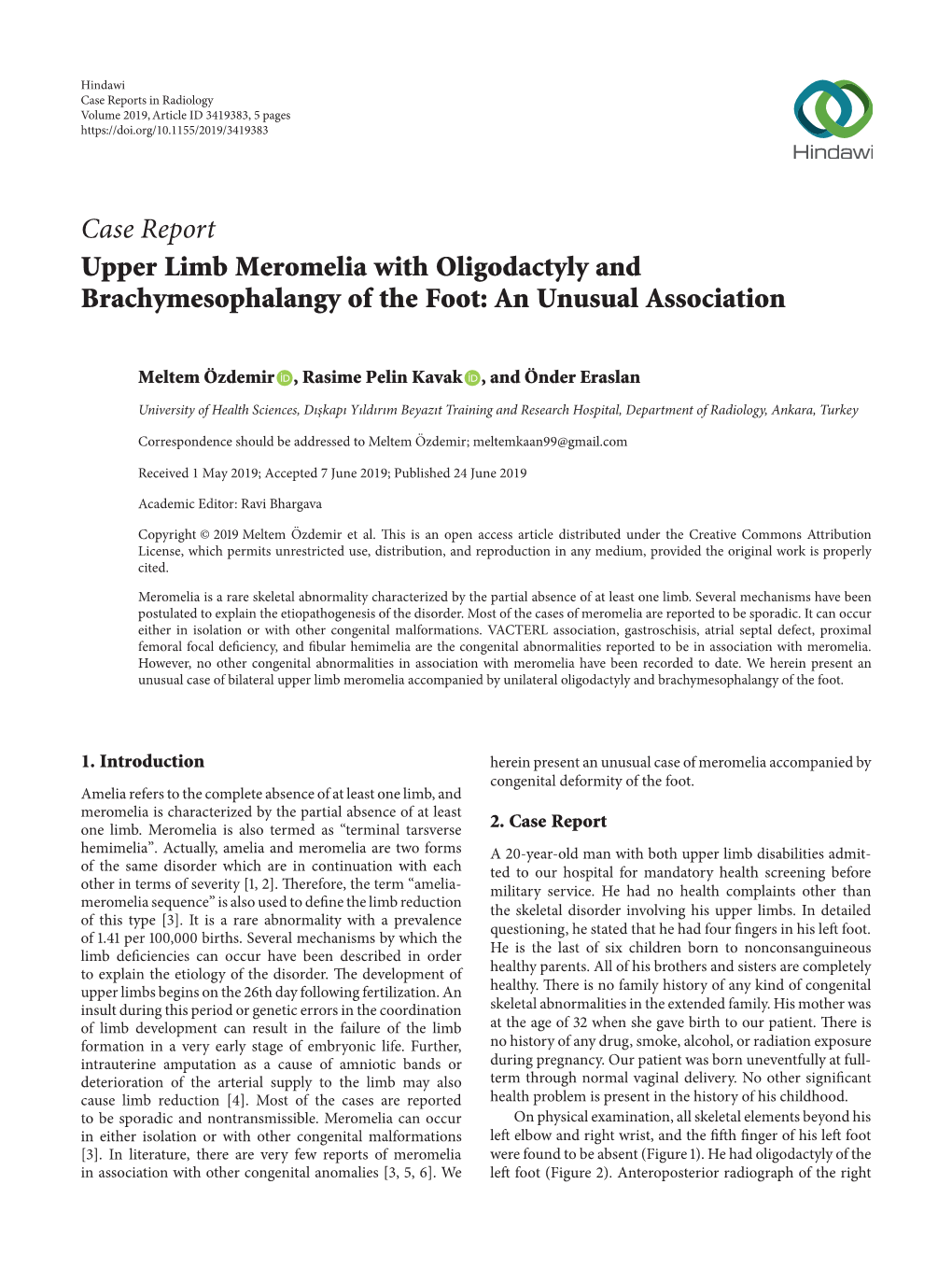 Case Report Upper Limb Meromelia with Oligodactyly and Brachymesophalangy of the Foot: an Unusual Association