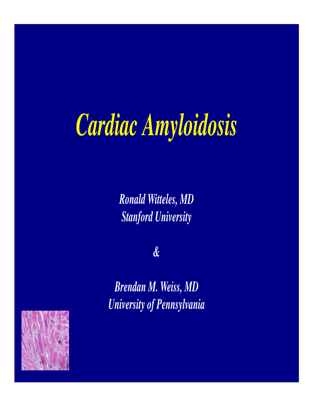 Cardiac Amyloidosis