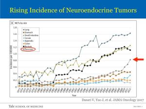 Rising Incidence of Neuroendocrine Tumors
